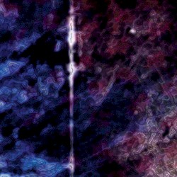 Theoretically Pure Anterograde Amnesia